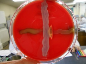 写真⑥「レンサ球菌の鑑別を行うCAMPテスト」